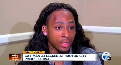 Gay Man's Beating Caught On Tape - Christin Howard, 20, was beat and left with a bloody eye, cuts and a broken finger during a gay pride festival in Detroit, this past weekend and the assault was caught on camera. The man was taking a photo with a friend, when another group of men began attacking him and yelling anti-gay slurs at him. Howard said to WXYZ, ?I thought they were going to kill me.?   (Photo: WXYZ-TV via ABC)