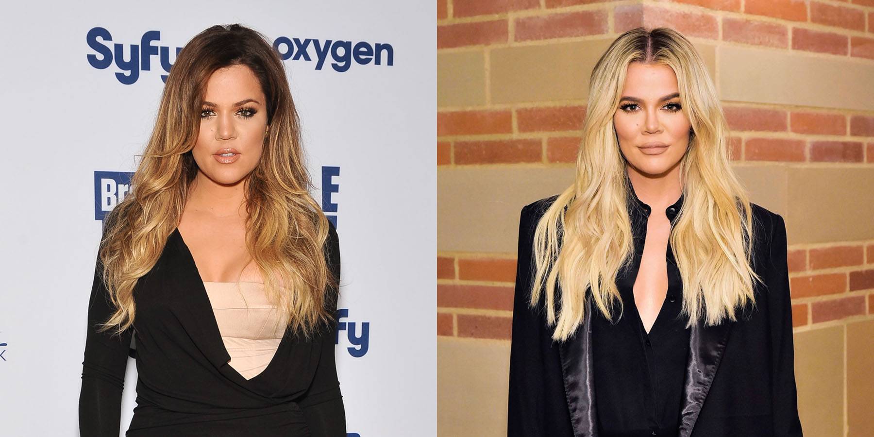 Khloe Kardashian Reveals How Much Plastic Surgery She's Had, News