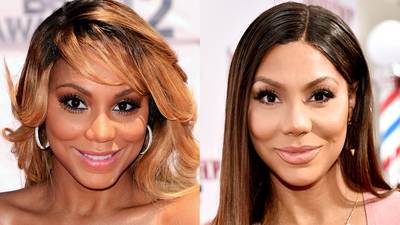 Tamar Braxton - Reality star and soul singer Tamar Braxton has been accused of skin lightening for years, which she has denied. Instead, she admitted to having vitiligo, the same melanin-depleting skin condition that model Winnie Harlow and Michael Jackson have.&nbsp;(Photos from Left: Jason Merritt/Getty Images For BET, Alberto E. Rodriguez/Getty Images)