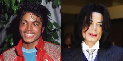 Michael Jackson - Michael Jackson's plastic surgery stories were almost as famous as his music. There was speculation for decades on what alterations he had — the list of possibilities is long — but even a lil' nip and tuck can't take away from his iconic genius.(Photos from left: Frank Edwards/Fotos International/Getty Images, Phil Klein-Pool/Getty Images)