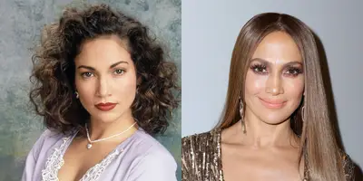 Jennifer Lopez - J.Lo has been rumored to have gone under the knife for everything from a nose job to cheek implants. Whatever the case, one can't deny Jenny from the Block looks hotter than ever.(Photos from left: CBS via Getty Images, John Parra/WireImage)