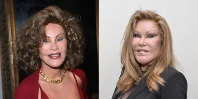 Jocelyn Wildenstein - You may not know her by her real name, but the &quot;Cat Lady&quot; might sound familiar. The socialite has allegedly spent $4,000,000 on plastic surgery — including eye work, several cheek implants, liposuction, brow lifts and more — to look more like a cat. After her last eye lift, she allegedly lost her peripheral vision. We hope it was worth it!(Photos from left: Evan Agostini/Liasion, Grant Lamos IV/Getty Images)