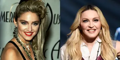 Madonna - Madge's evolving look suggests she has gone under the knife a time or two. Her own brother revealed she had a face lift, saying that he could no longer recognize her. We don't blame the Material Girl for wanting her face to keep up with her ageless body.(Photos from left: Julian Wasser/Liaison, Kevin Mazur/Getty Images for iHeartMedia)