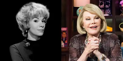 Joan Rivers - Joan Rivers often joked about going under the knife, and we don't have enough space to list her extensive surgeries. The comedy icon, who passed away last September, was always unapologetic about her procedures.&nbsp;(Photos from left: James Kriegsmann/Michael Ochs Archives/Getty Images, Charles Sykes/Bravo/NBCU Photo Bank via Getty Images)