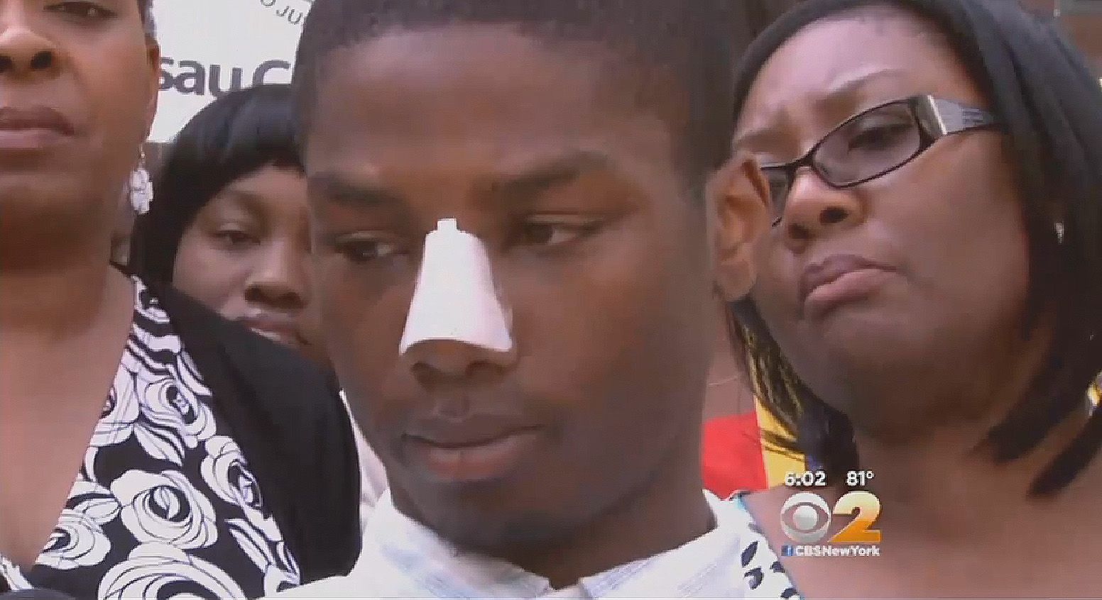 NY Man Wants Feds to Prosecute Police Beating Case News BET
