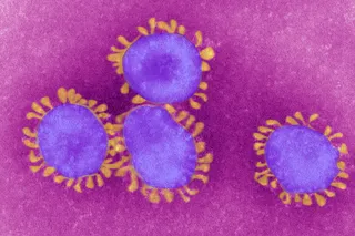 SARS-Like Virus Found in Middle East - Global health officials are keeping a watchful eye on a new respiratory virus related to SARS that has been blamed for the death of one person in&nbsp;Saudi Arabia&nbsp;and left another person in critical condition in&nbsp;Britain.(Photo: GettyImages)