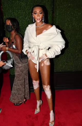 Winnie Harlow - (Photo by Kevin Mazur/MTV VMAs 2021/Getty Images for MTV/ ViacomCBS)