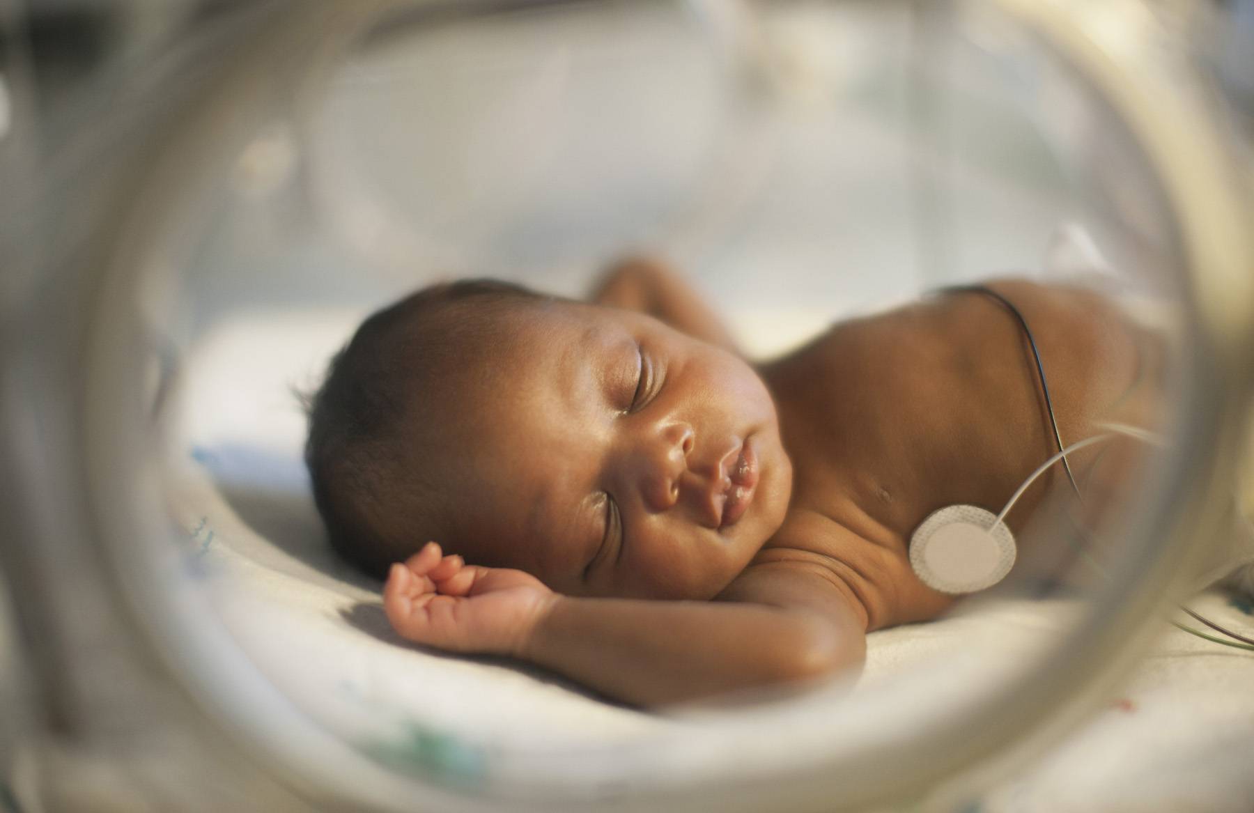 The Health of Black Babies