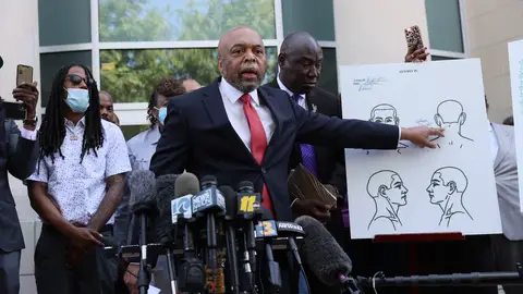 ELIZABETH CITY, NORTH CAROLINA - APRIL 27:  Wayne Kendall, one of the lawyers representing the family of Andrew Brown Jr.,  points to an autopsy chart that his team conducted showing where Mr. Brown was shot on April 27, 2021 in Elizabeth City, North Carolina. Mr. Kendall and family members spoke to the media about the 20 seconds of police body camera footage they were shown and an autopsy they performed after the shooting death of Andrew Brown Jr. on April 21 by Pasquotank County Sheriff deputies. (Photo by Joe Raedle/Getty Images)