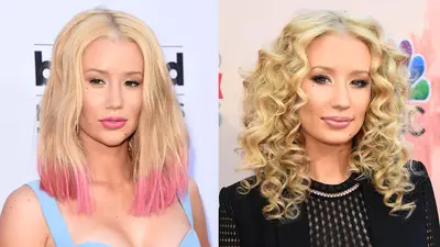 Iggy Azalea - Much has been said and written about Iggy's booty, but at the Billboard Music Awards, it was her newly-streamlined face that nobody could take their eyes off of. It's pretty obvious that the Aussie pop star got a nose job and a chin implant, just months after she admitted to getting breast implants. Hey, whatever makes her feel good. At least she's not trying to convince us her new look is a result of clever contouring.  (Photos from left: Jason Merritt/Getty Images, Frazer Harrison/Getty Images for iHeartMedia)