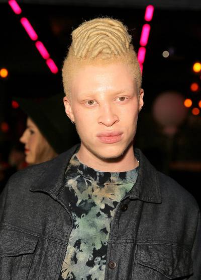 Shaun Ross - Not only is he everyone's fave model, but he's also our fave inspiration for leading the charge with a self-empowerment campaign entitled #InMySkinIWin.  (Photo: Chelsea Lauren/Getty Images for NYLON)