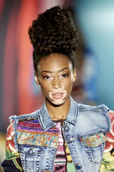Winnie Harlow - A unique beauty that's changing the landscape of modeling one campaign at a time. (Photo: Carlos Alvarez/Getty Images)