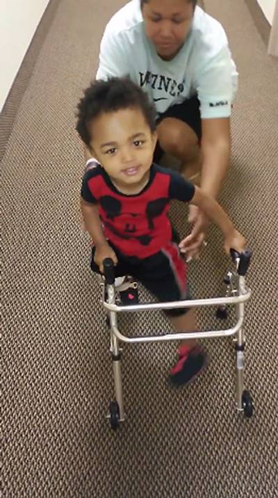 2-Year-Old Amputee Takes First Steps - Kayden, 2, is inspiring people on the internet as a video of the boy whose right and left foot was amputated, took his first steps by himself. &quot;I got it! I got it!&quot; the boy yelled as he moved his feet. Kayden was born with omphalocele, which left his intestines, liver and bladder defected.   (Photo: Nikki Sessoms via YouTube.com)