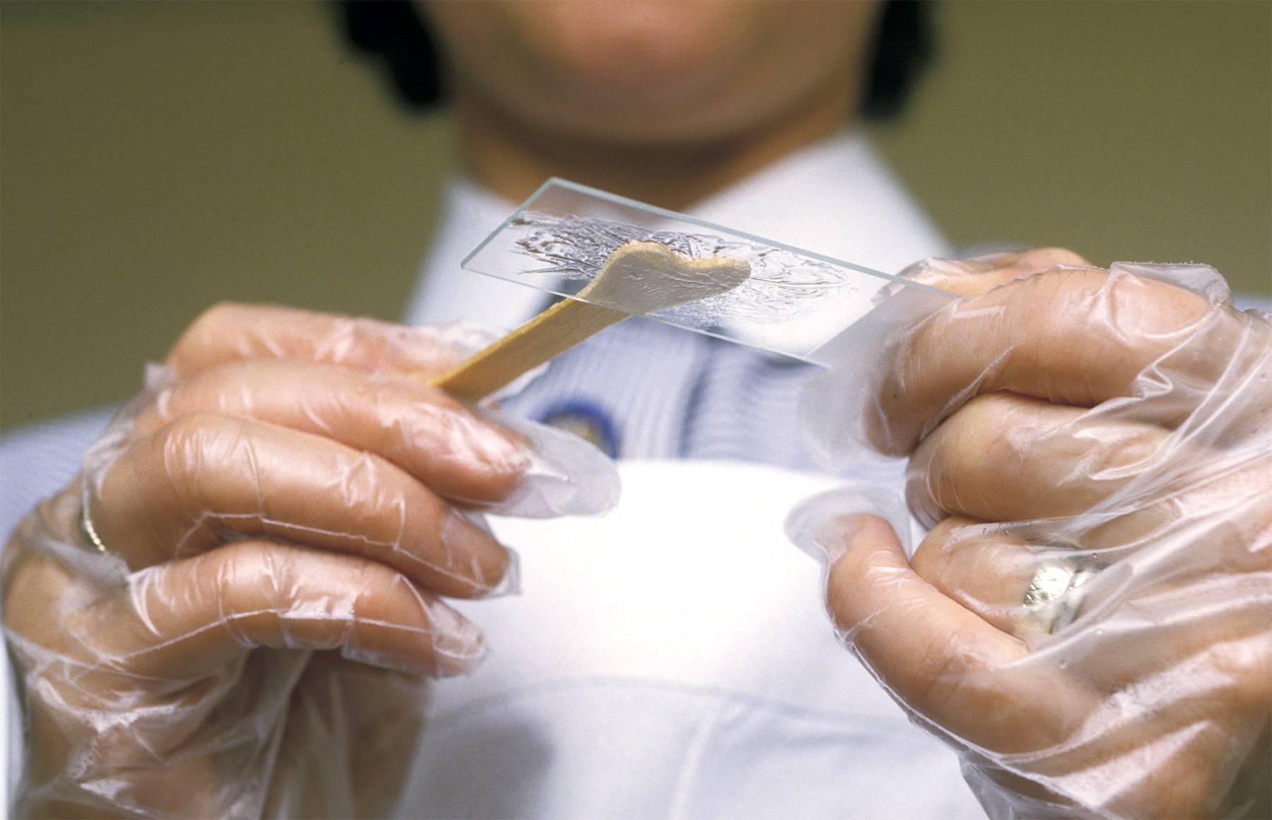 Cloning Henrietta Lacks’s Cervical Image 3 from Medical Racism What