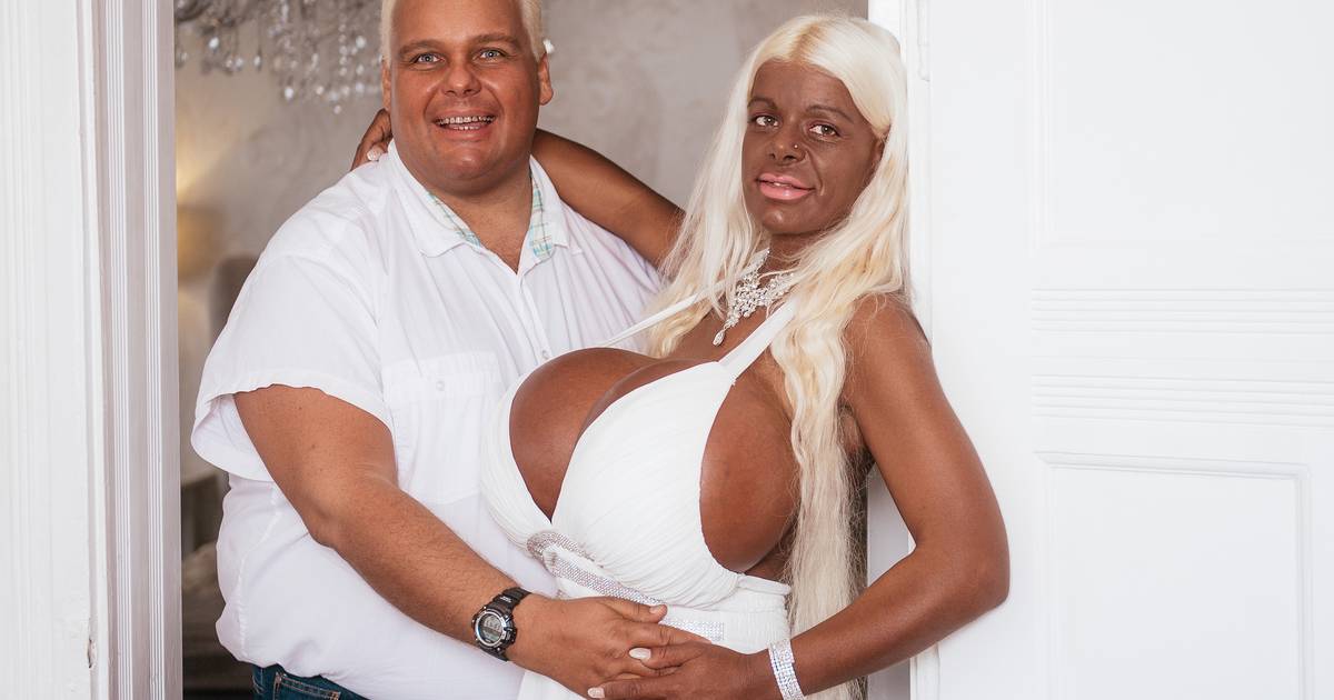 Who is Martina Big? Woman with 32S boobs was born white but used tanning  injections and now identifies as black