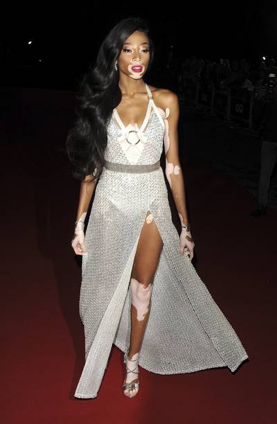 Gorge - Winnie Harlow turned heads while arriving at the GQ Men of the Year Awards 2017.&nbsp;(Photo: WENN.com)