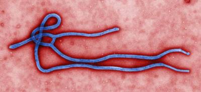 What Is Ebola? - Discovered in 1976, Ebola is a rare virus that kills 60 percent of those who come in contact with it. More than 6,800 people have died from the virus, says the World Health Organization.&nbsp;(Photo: AP Photo/CDC)
