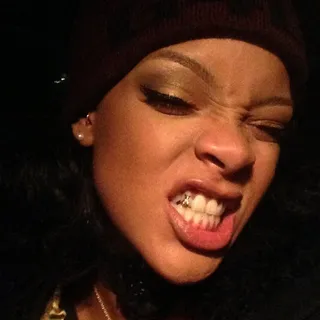 Rihanna @badgalriri - Rihanna shows off latest fashion accessory… a gold tooth! We are convinced Rih could try just about anything and still have us mesmerized.&nbsp;(Photo: Rihanna via Instagram)