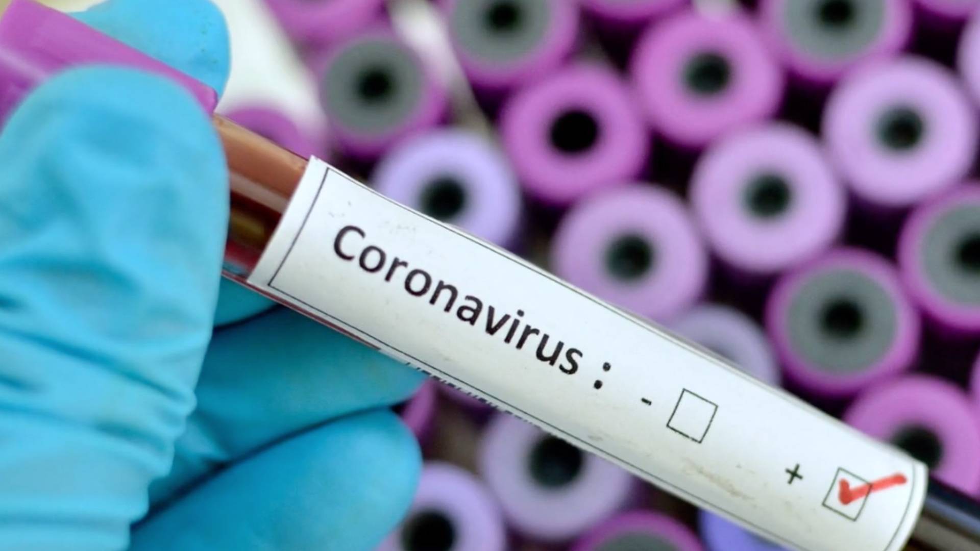 Coronavirus testing on BET BUZZ 2020.