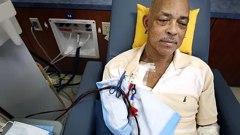 African-Americans Less Likely to Receive Kidney Transplants