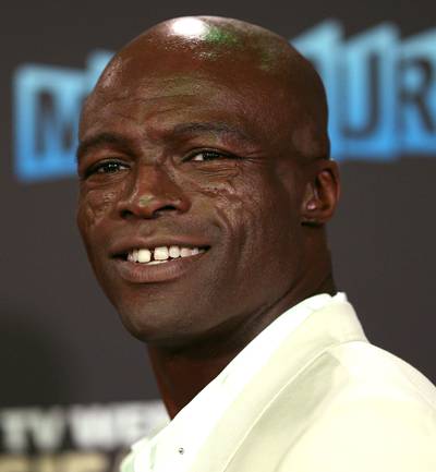 Seal - The scars on Seal?s cheeks are due to a form of lupus that attacks the skin and causes extreme inflammation, especially in sun-exposed areas. The ?Kiss from a Rose? singer has said in interviews that he was diagnosed with the condition as a teen. The disease also affected his scalp and caused hair loss.(Photo: Ryan Pierse/Getty Images)