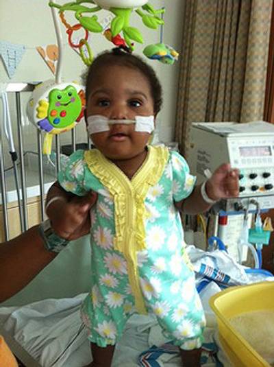 One of Two Conjoined Twins Passes Away - A?zhari Lawrence, one of the African-American conjoined twins born last October, has died, says a Virginia Commonwealth University Medical Center press release. However, her sister, A?zhiah, who is also hospitalized, is in ?good condition.? The twins were conjoined at the chest and stomach and were surgically separated in April of 2013.&nbsp;(Photo: Courtesy A'zhari Renai Lawrence Family via Hamilton Funeral Chapel)