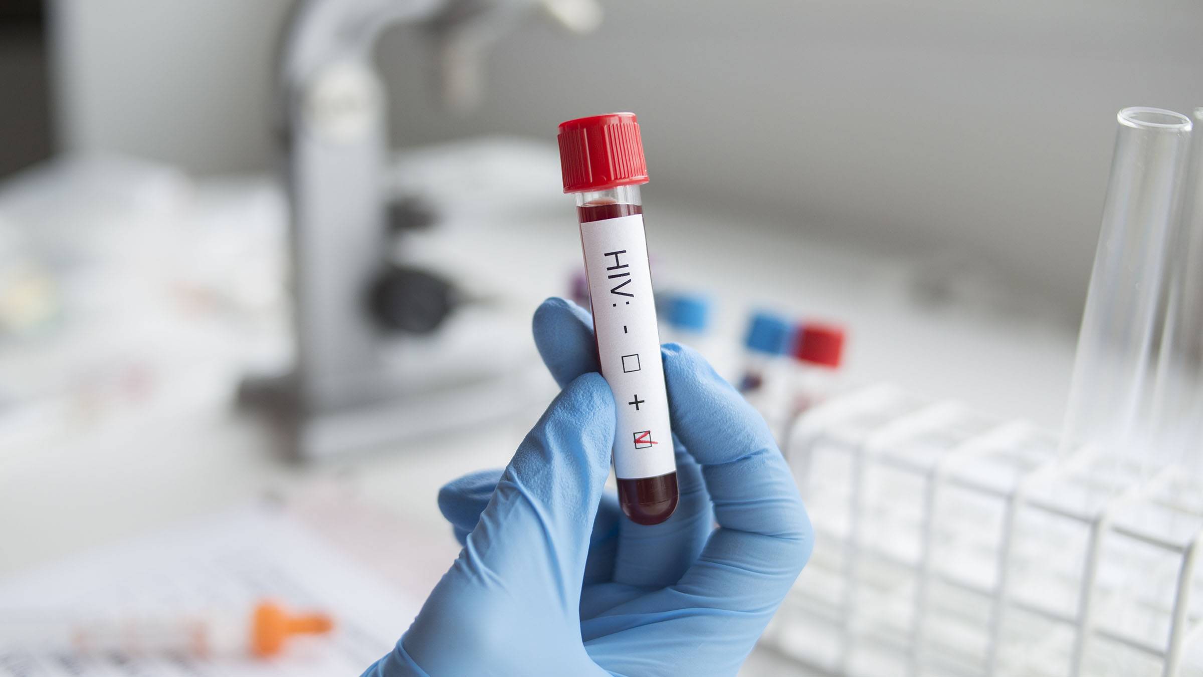 Black Women Make Up Majority Of New HIV Cases And Aren't Getting The Relative Care | News - Vimarsana News