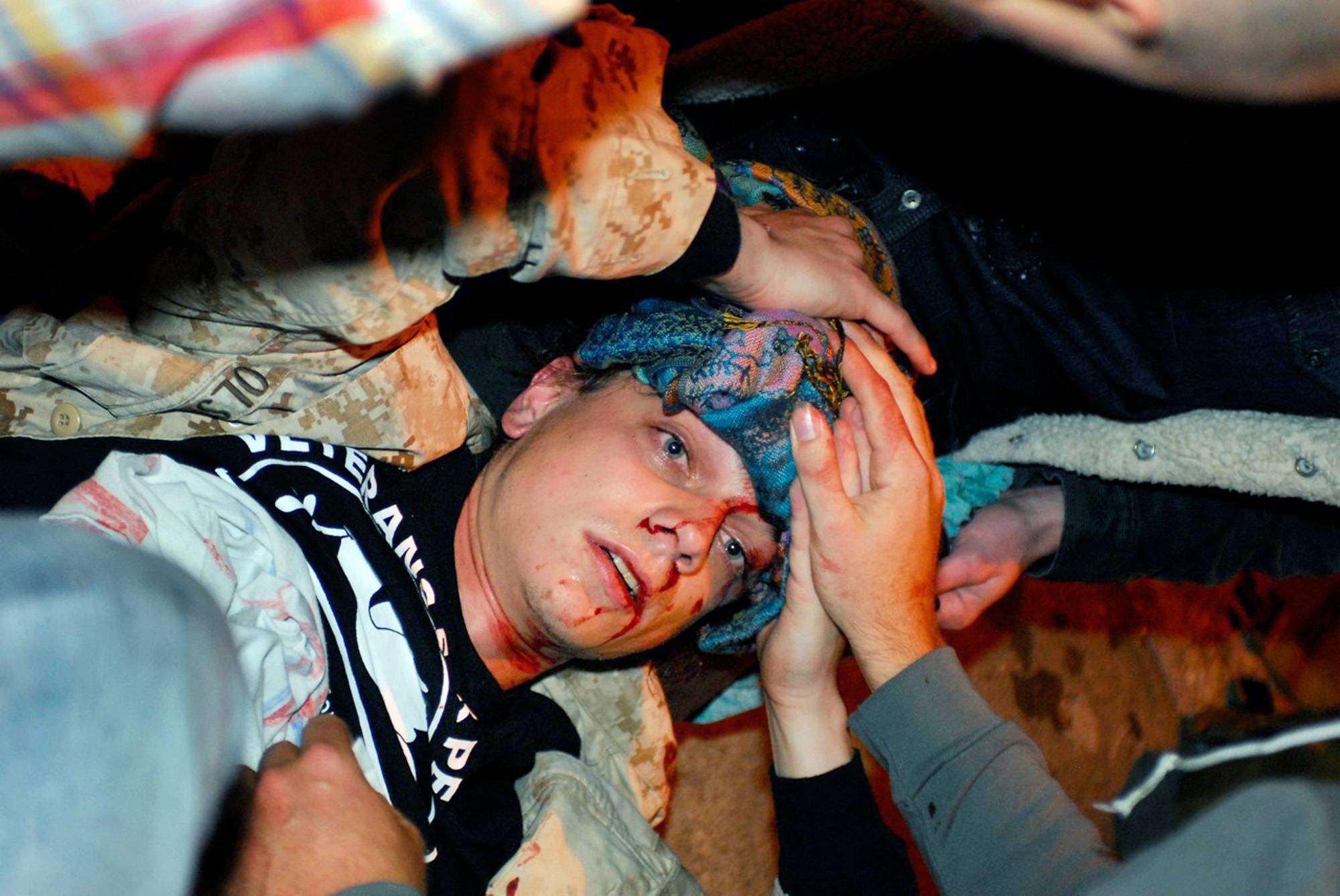 Occupy Oakland Gets Violent - Scott Olsen, 24, an ex-Marine and veteran of the Iraq War, suffered a fractured skull when police flung an object — possibly a tear gas canister — at a group of Occupy Oakland protesters on Tuesday. Other demonstrators rushed to his aid but, to their surprise, as they helped Olsen, an officer tossed another canister toward the group, a video shows.(Photo: AP Photo/Jay Finneburgh)