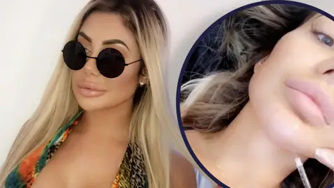 Geordie Shore star Chloe Ferry gets fat melting injections in her 'double chin'