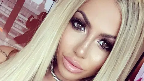 Holly Hagan is a living Barbie Doll now 