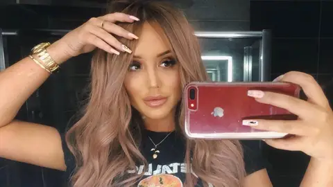 Charlotte Crosby is proud of her lip filler