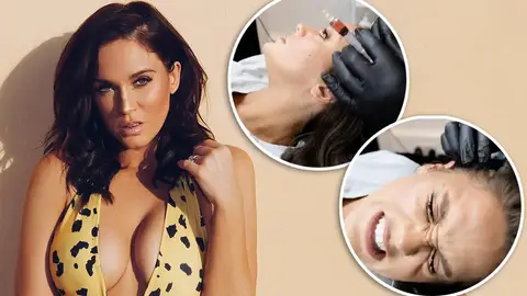 Geordie Shore's Vicky Pattison undergoes PRP hair procedure from Dr Tijion Esho from London's Harley Street