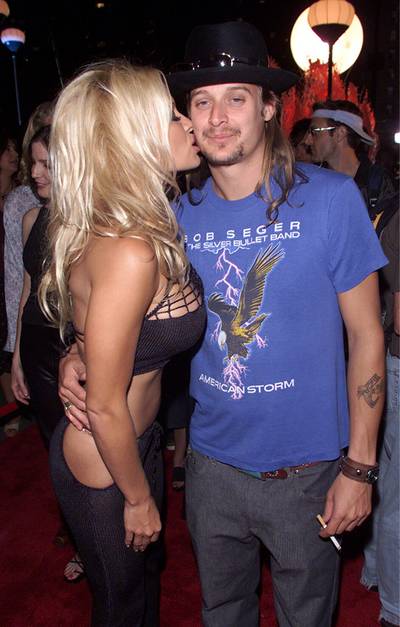 Kid Rock and Pamela Anderson at the 2001 VMAs.