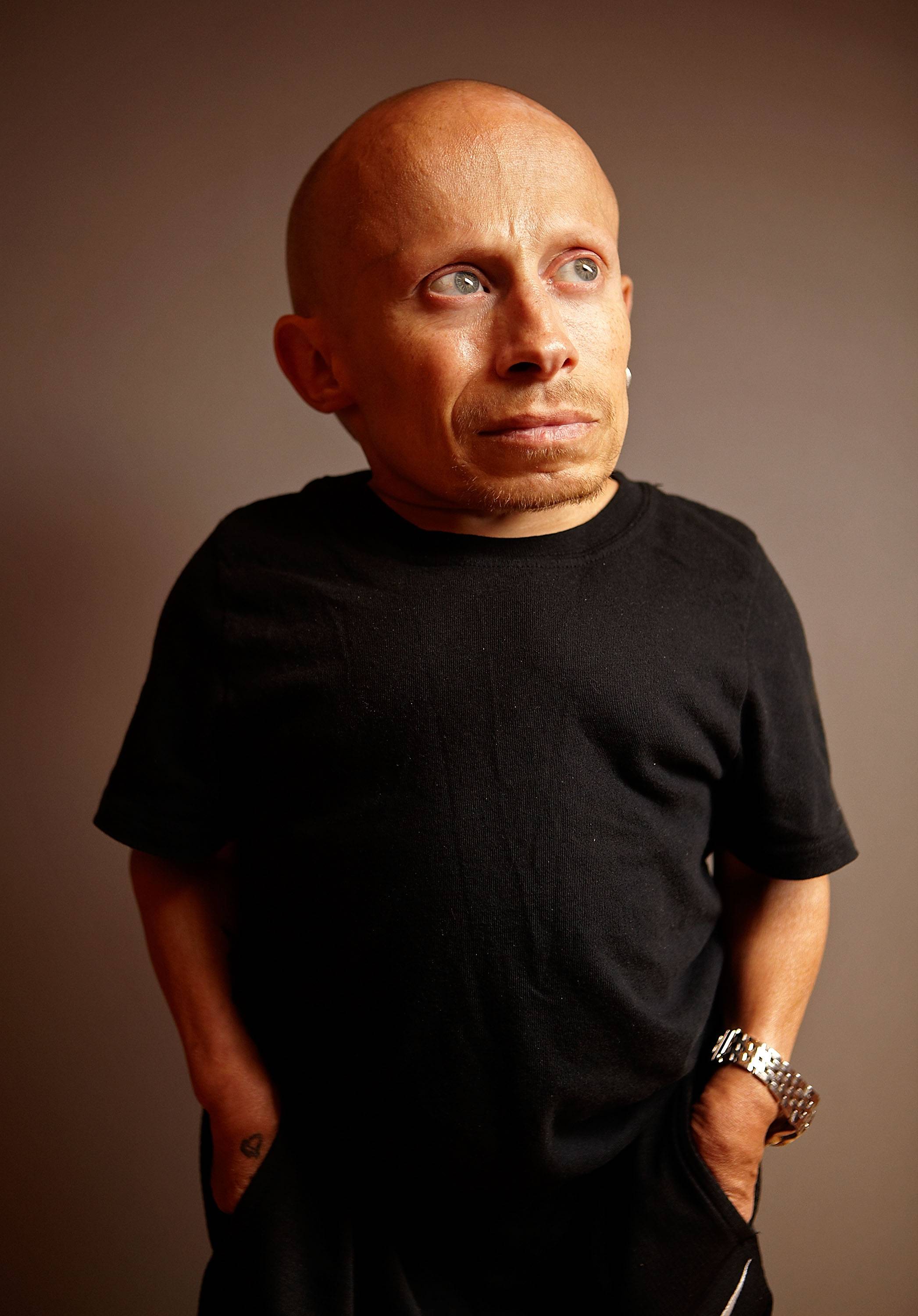 Verne Troyer Austin Powers Actor Dead At 49 News Mtv