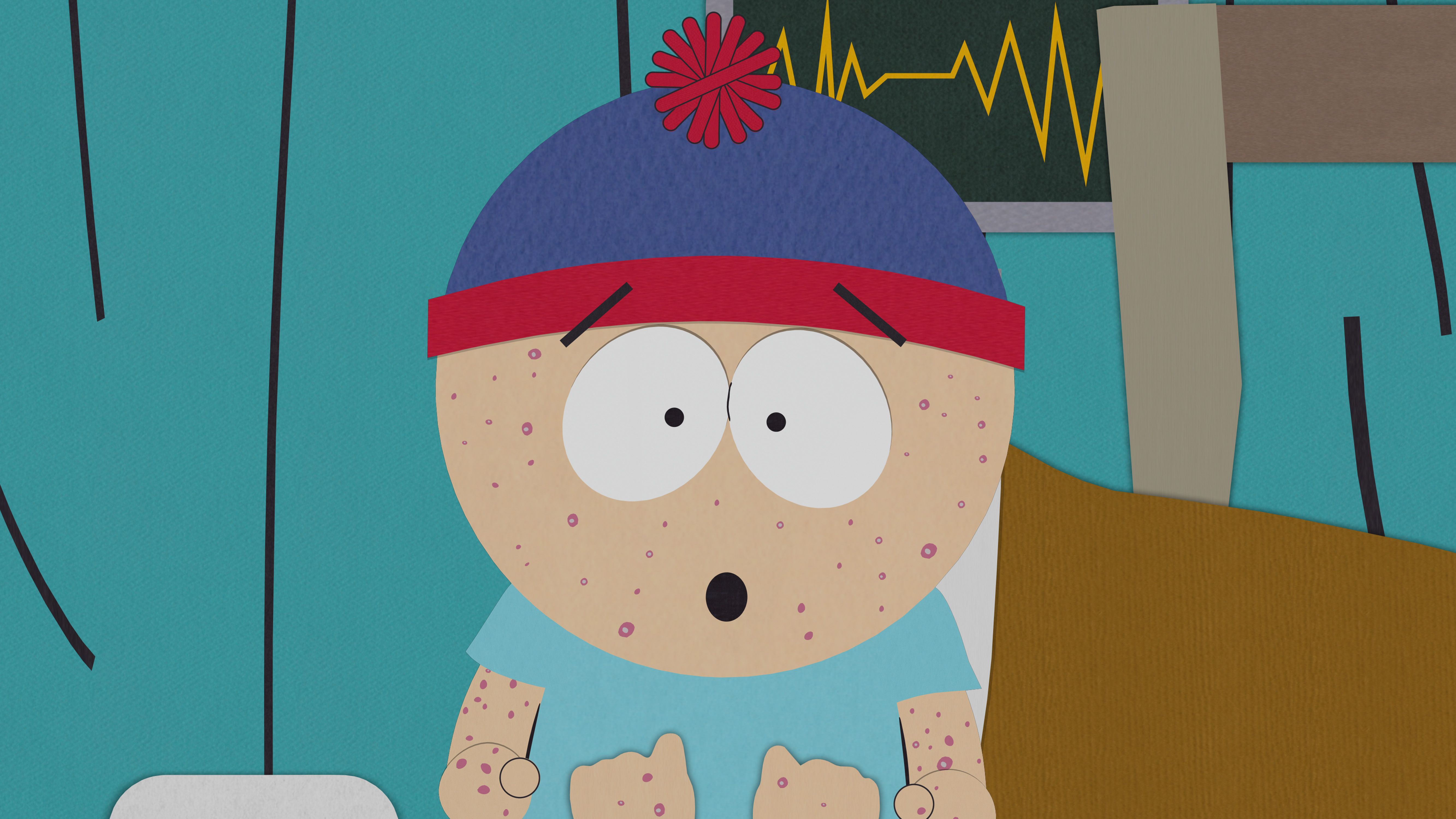 South Park Season 2, 10 Chickenpox Full Episode South