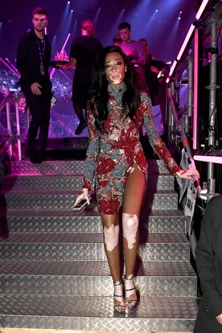 mgid:file:gsp:scenic:/international/mtvema/2016/images/galleries/_night-of/highlights/WinnieHarlow-621513954.jpg